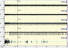 筋肉の活動電流測定